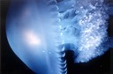 BlueJellyFish